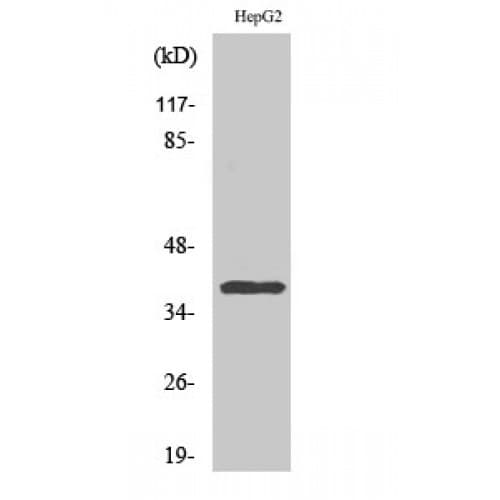 CCRL2 Antibody (110-190 aa, Internal)