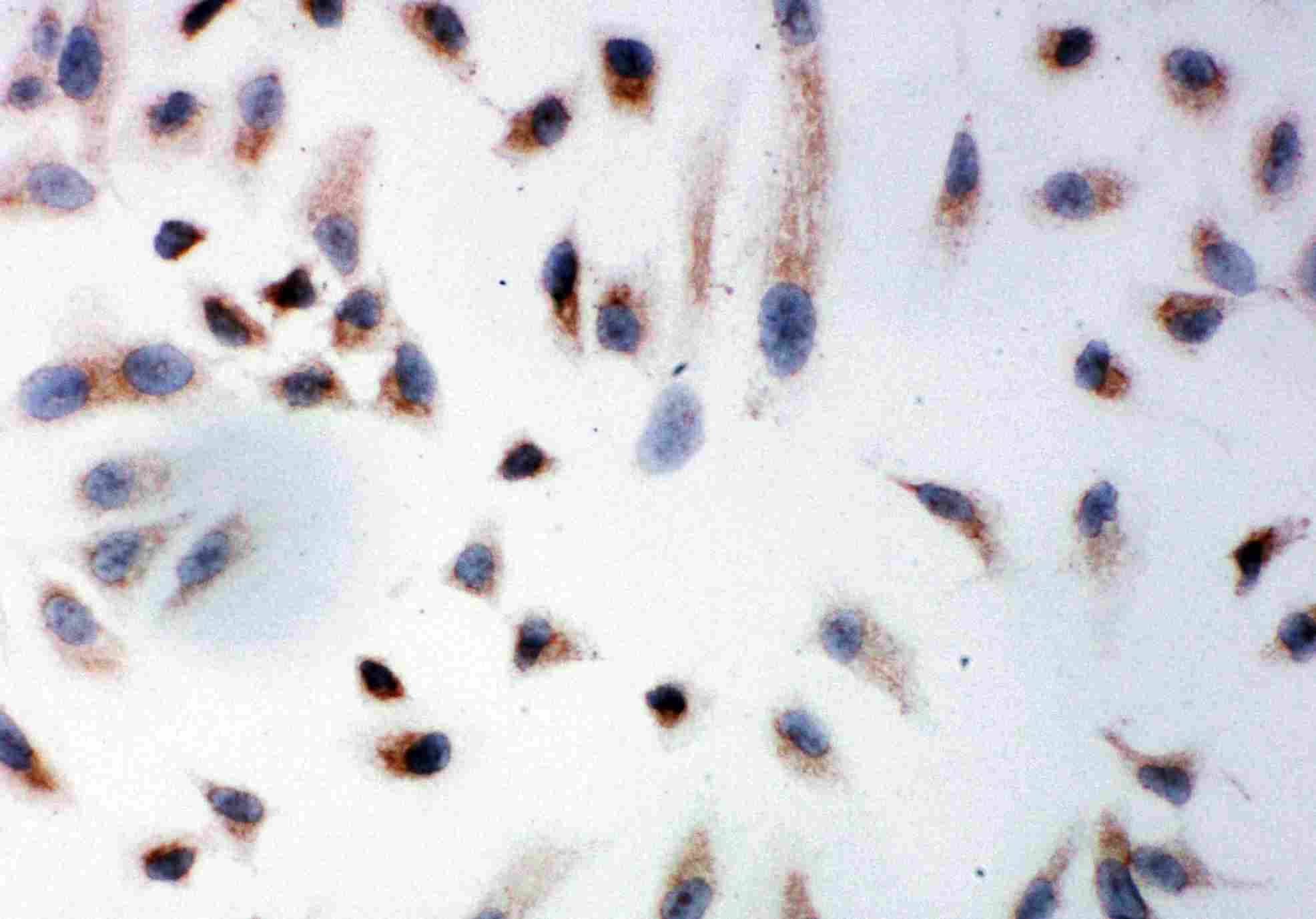 Polyclonal Rabbit anti-Human PHB / Prohibitin Antibody (aa240-256, IHC, WB)