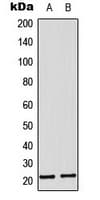 Polyclonal Rabbit anti-Human MRPL11 Antibody (Internal, IHC, IF, WB)