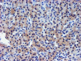 TIMP2 Antibody (clone OTI2G7)