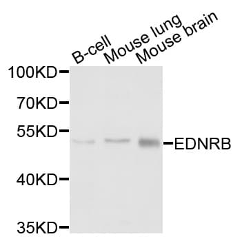 EDNRB / Endothelin B Receptor Antibody