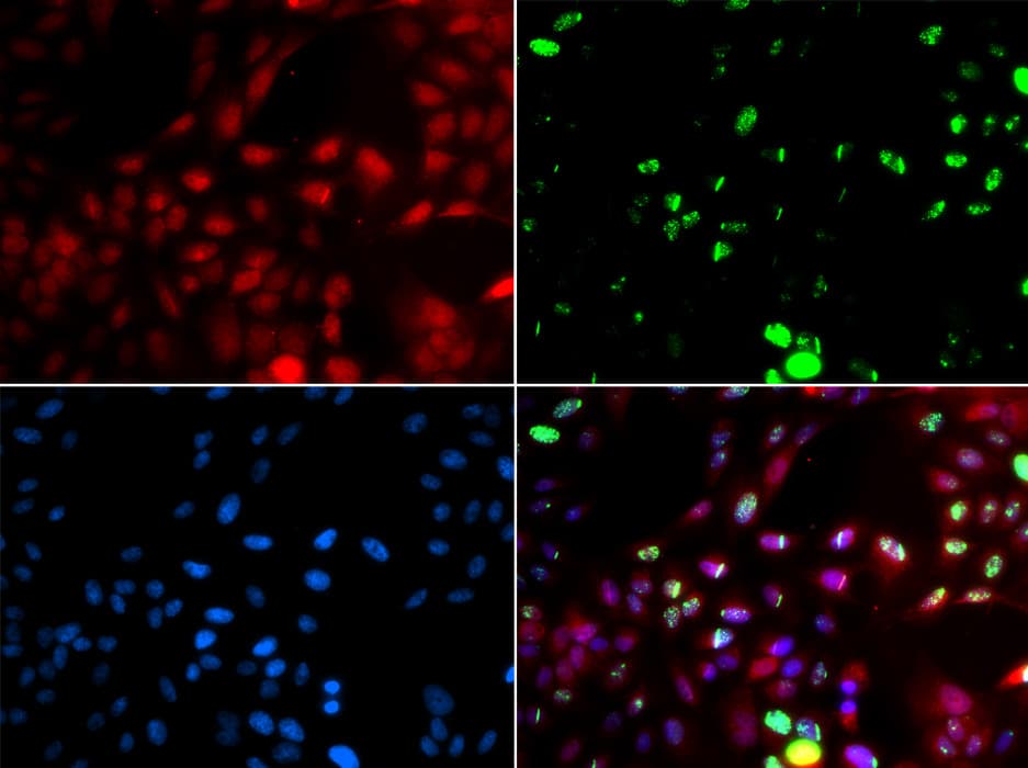IHC-plus™ Polyclonal Rabbit anti-Human POLK / DNA Polymerase Kappa Antibody (IHC, IF, WB)