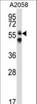 Polyclonal Rabbit anti-Human DPYSL3 / CRMP4 Antibody (aa461-490, IHC, WB)