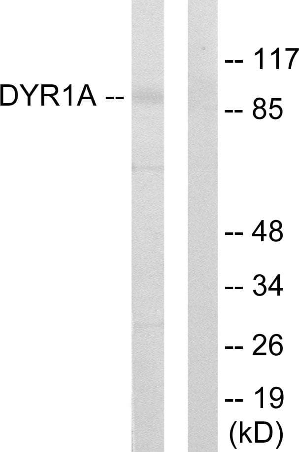 DYRK / DYRK1A Antibody