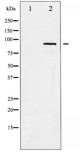 ADD1 / Adducin Alpha Antibody (phospho-Ser726)