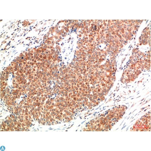 ATM Antibody