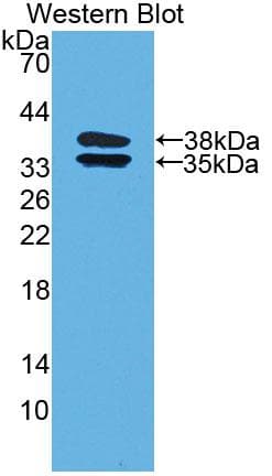 C2CD3 Antibody (aa2051-2323, Biotin)