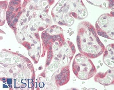 IHC-plus™ NXP2 / MORC3 Antibody (aa634-663)