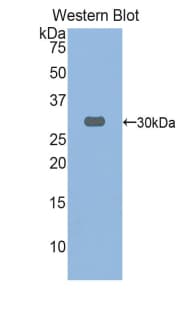 SPHK / SPHK1 Antibody (aa148-398)