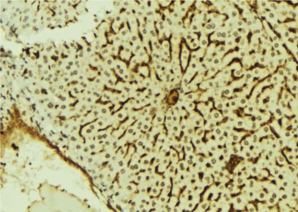 Polyclonal Rabbit anti-Human SCML2 Antibody (IHC, WB)
