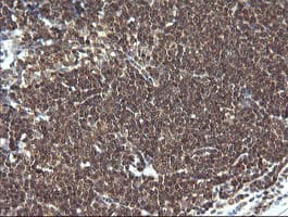 LZIC Antibody (clone OTI5E3)