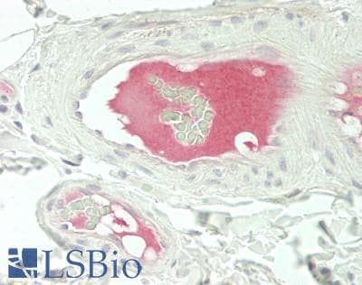 IHC-plus™ Polyclonal Rabbit anti-Human LRG1 / LRG Antibody (IHC, WB)