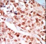 PRKAG1 / AMPK Gamma 1 Antibody (aa265-295)