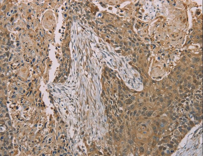S100A6 / Calcyclin Antibody