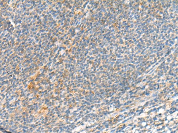 TSHB / TSH-Beta Antibody