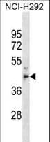 MPPE1 / PGAP5 Antibody (aa261-289)