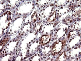 UPRT Antibody (clone OTI1A3)