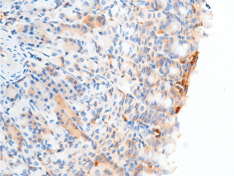 CHEK2 / CHK2 Antibody (phospho-Ser516)