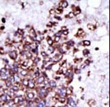 Polyclonal Rabbit anti-Human CAMK1 / CAMKI Antibody (aa341-370, IHC, WB)