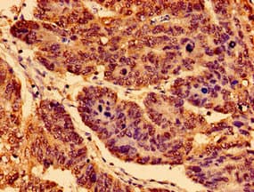 NTRK1 / TrkA Antibody