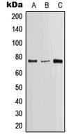 Polyclonal Rabbit anti-Human LCP2 / SLP-76 Antibody (Internal, WB)