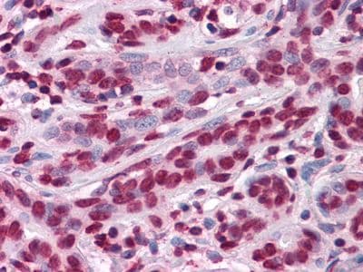 ZBTB7B / HcKrox Antibody (clone 7C12)