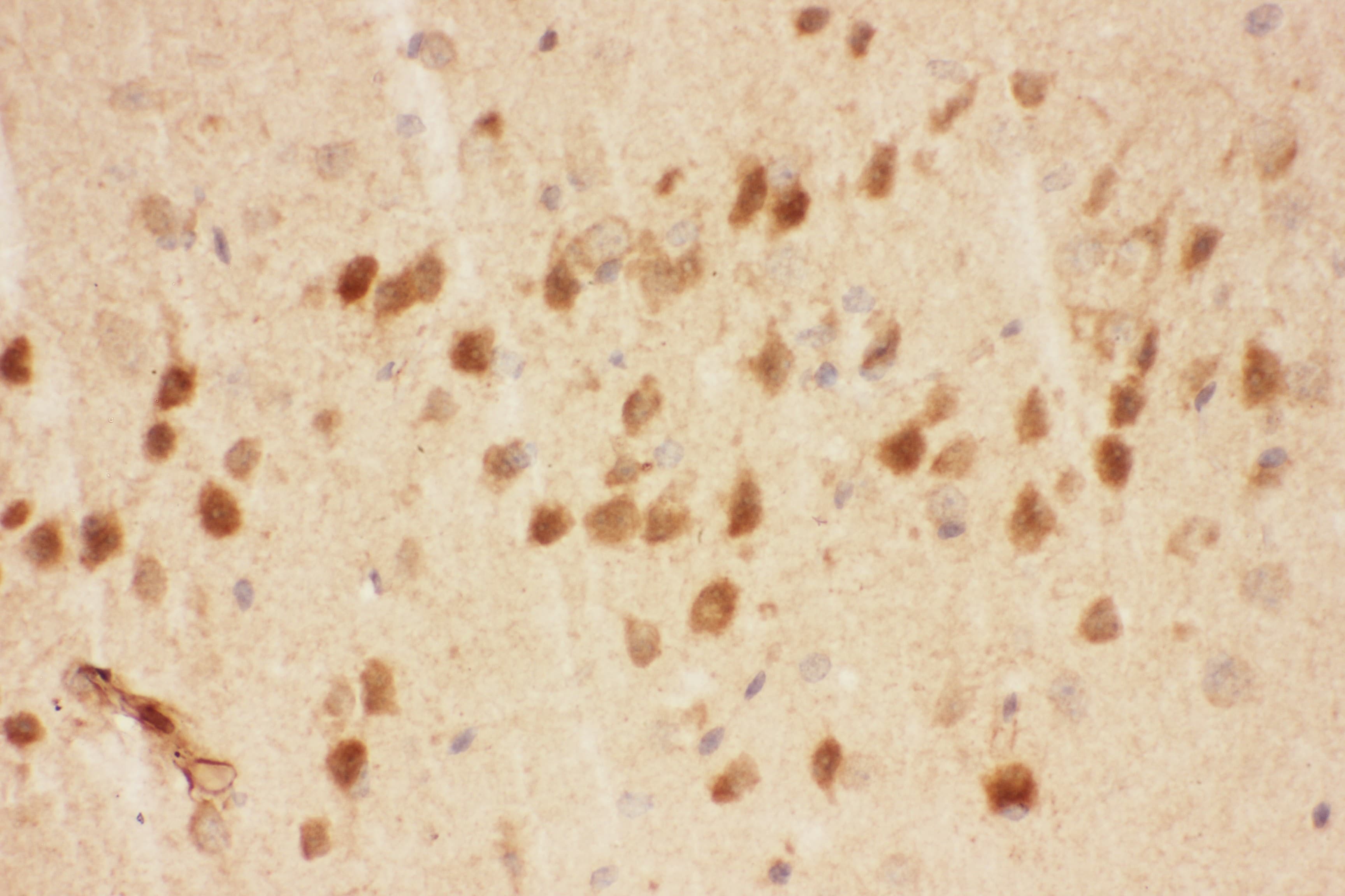 Polyclonal Rabbit anti-Human BDNF Antibody (aa129-247, IHC, WB)