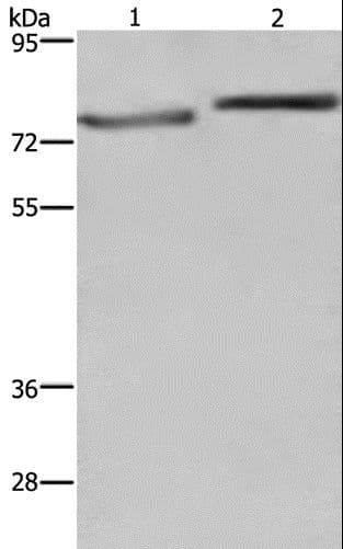 COMP / THBS5 Antibody