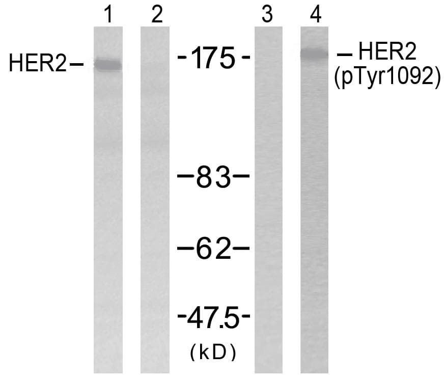 EGFR Antibody (phospho-Tyr1092)