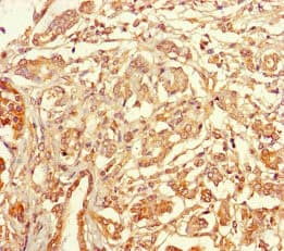 Polyclonal Rabbit anti-Human TSPAN7 / CD231 Antibody (WB)