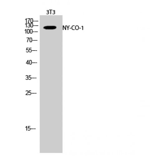 SDCCAG1 / NEMF Antibody (850-930 aa, C-terminal)