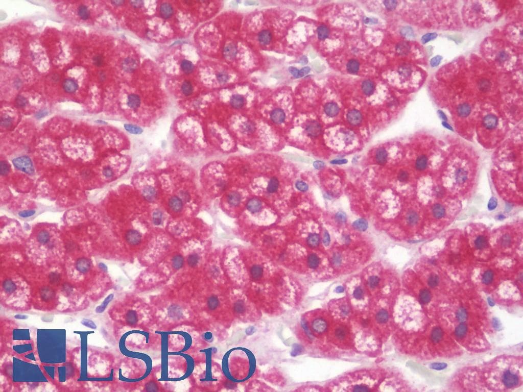 IHC-plus™ Polyclonal Rabbit anti-Human SLC22A4 / OCTN1 Antibody (aa514-542, IHC, WB)