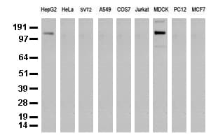 Monoclonal Mouse anti-Human ERBB2 / HER2 Antibody (clone UMAB34, Carrier-free, aa676-1255, IHC, IF, WB)