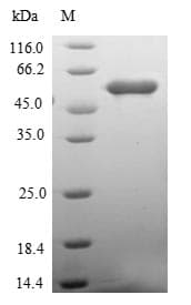 Human RCHY1 / PIRH2 Protein (Recombinant GST, N-terminus)