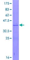 Human L35A / RPL35A Protein (Recombinant GST)