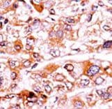 Polyclonal Rabbit anti-Human CDKN1A / WAF1 / p21 Antibody (phospho-Thr57, IHC)