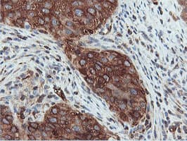 Monoclonal Mouse anti-Human PFKP Antibody (clone OTI3A12, IHC, IF, WB)