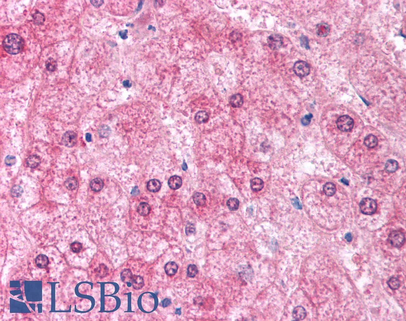 IHC-plus™ Polyclonal Rabbit anti-Human EIF2AK2 / PKR Antibody (IHC, WB)