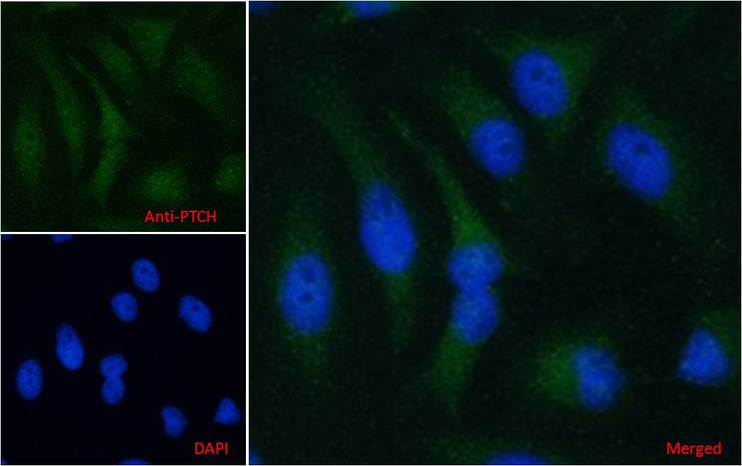 IHC-plus™ PTCH1 / Patched 1 Antibody (aa1431-1442)