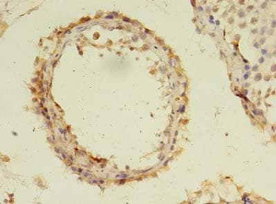 C19orf47 Antibody