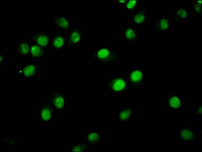 HIST1H2BN Antibody