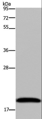 NDUFA8 Antibody