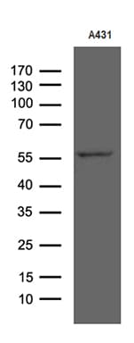 RIPK3 / RIP3 Antibody (aa233-518, clone OTI1D8)