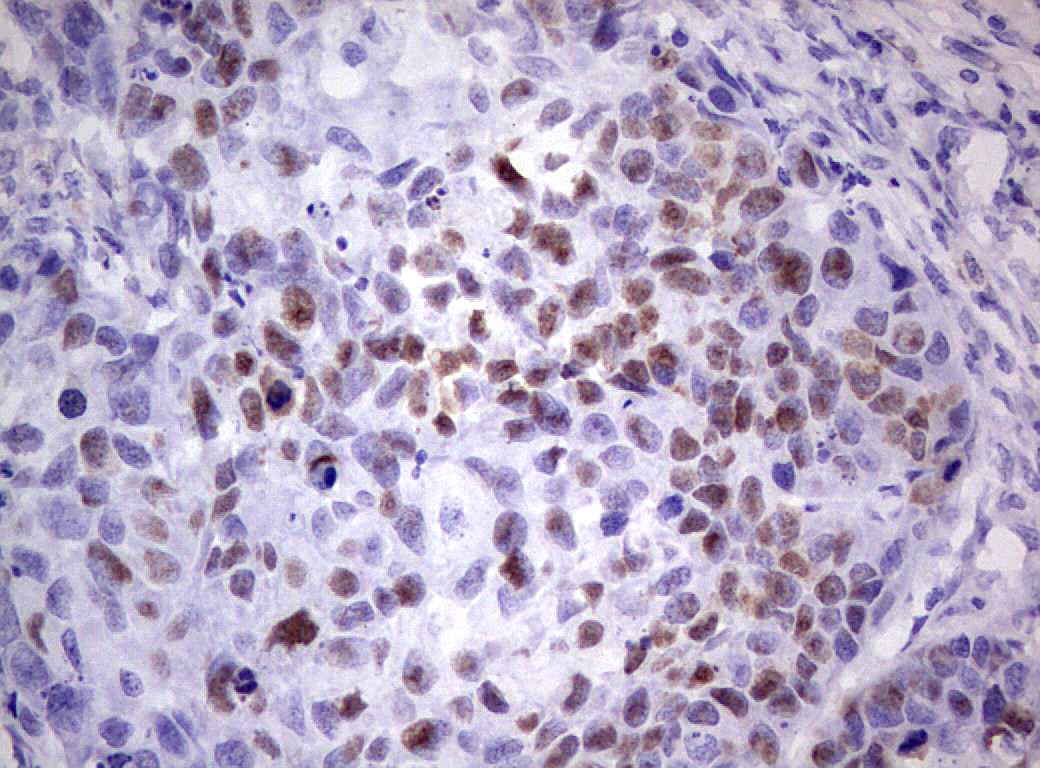 Monoclonal Mouse anti-Human TP53 / p53 Antibody (clone OTI7A11, IHC, WB)