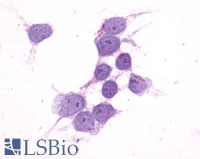 PathPlus™ P2RY14 / GPR105 Antibody (C-Terminus)