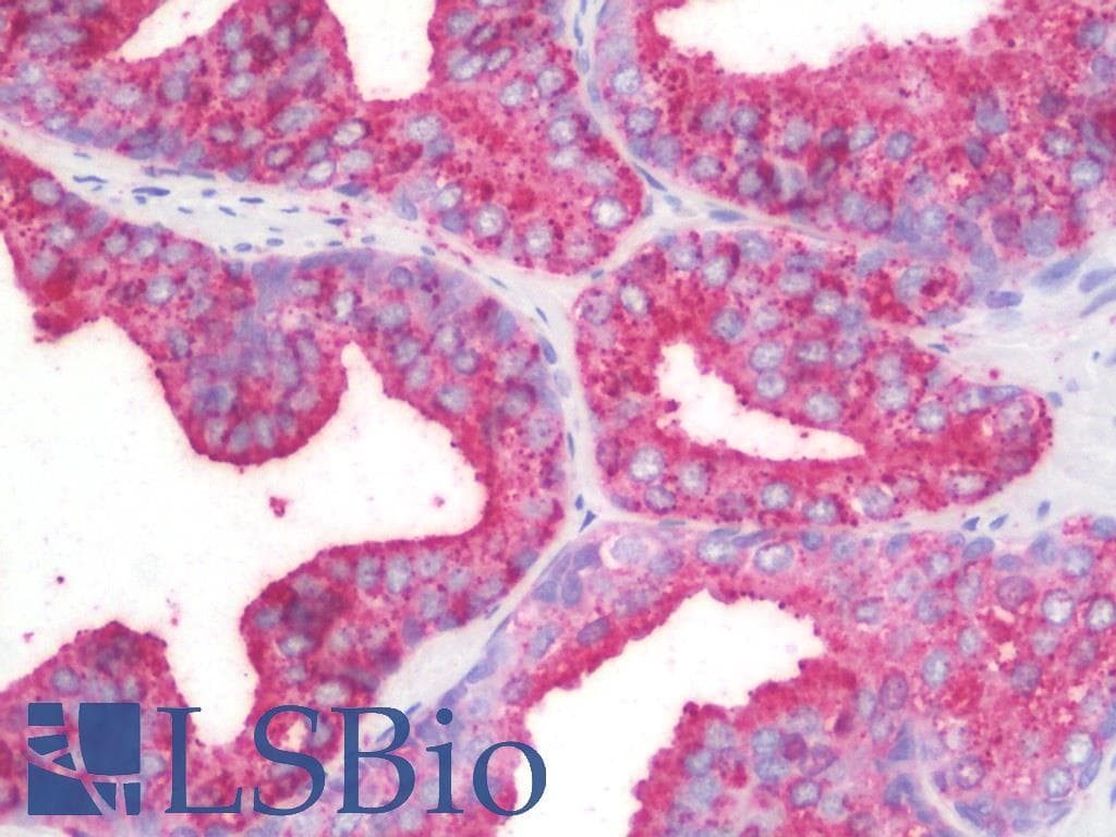 IHC-plus™ Polyclonal Rabbit anti-Human CHCHD6 Antibody (IHC, WB)