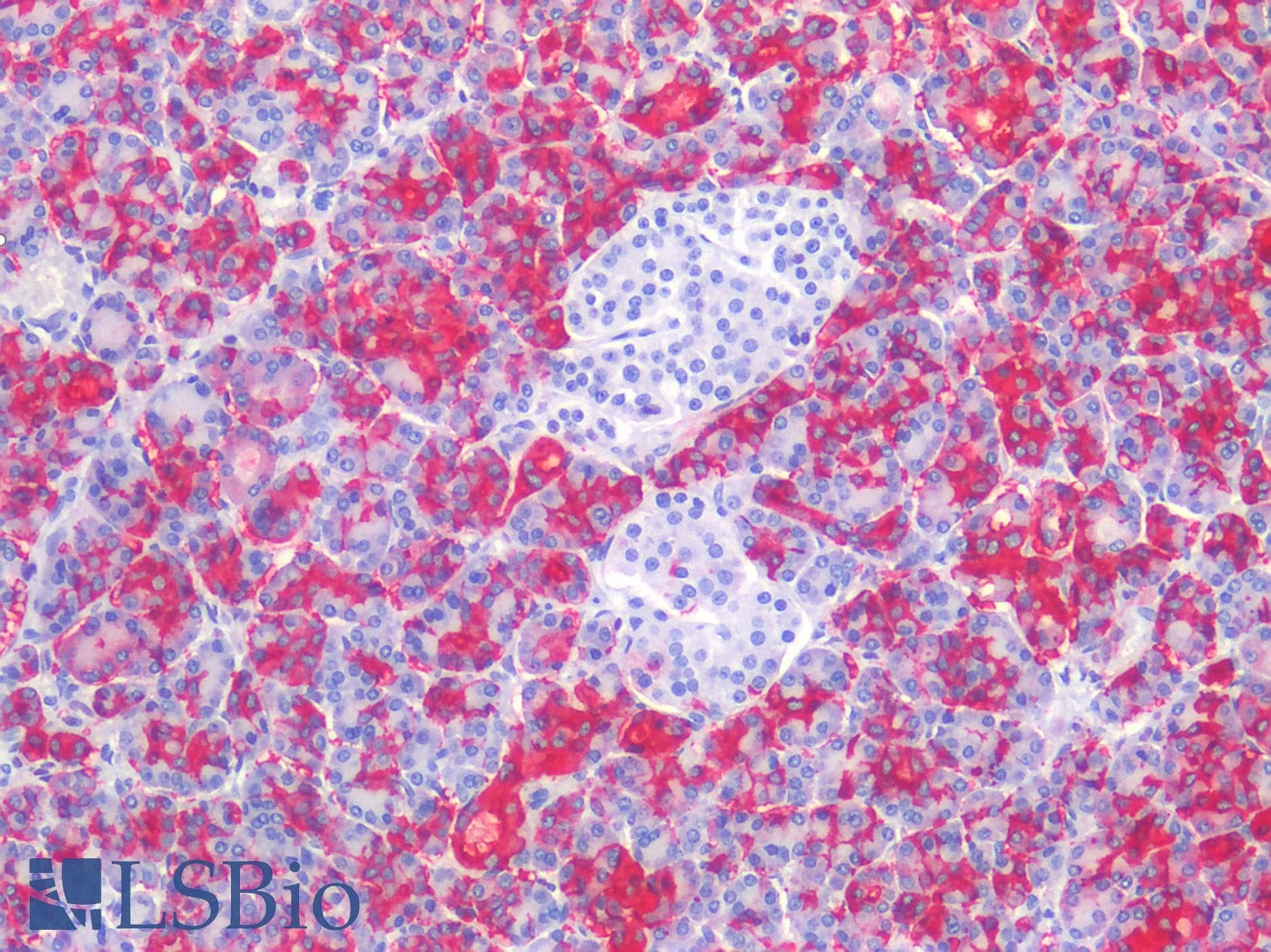 PathPlus™ Monoclonal Mouse anti-Human Sialylated Lewis a / CA 19-9 Antibody (IHC)