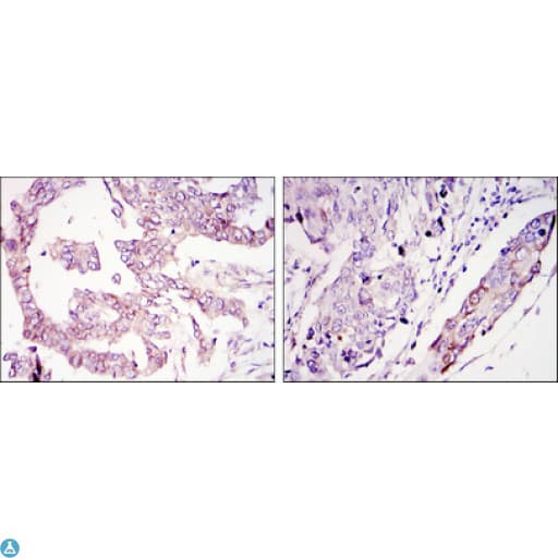 WIF1 Antibody