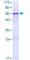 Human CARKD Protein (Recombinant GST)
