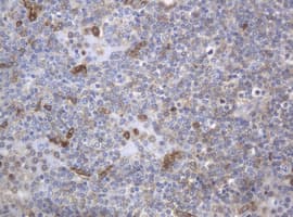 c-Kit / CD117 Antibody (clone OTI2E3)